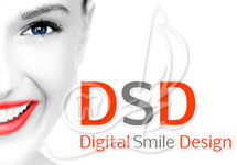 digital smile desing