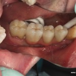 chirurgia dentystyczna iława
