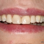 chirurgia dentystyczna iława