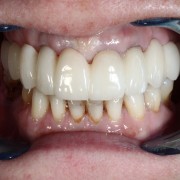 dentysta iława