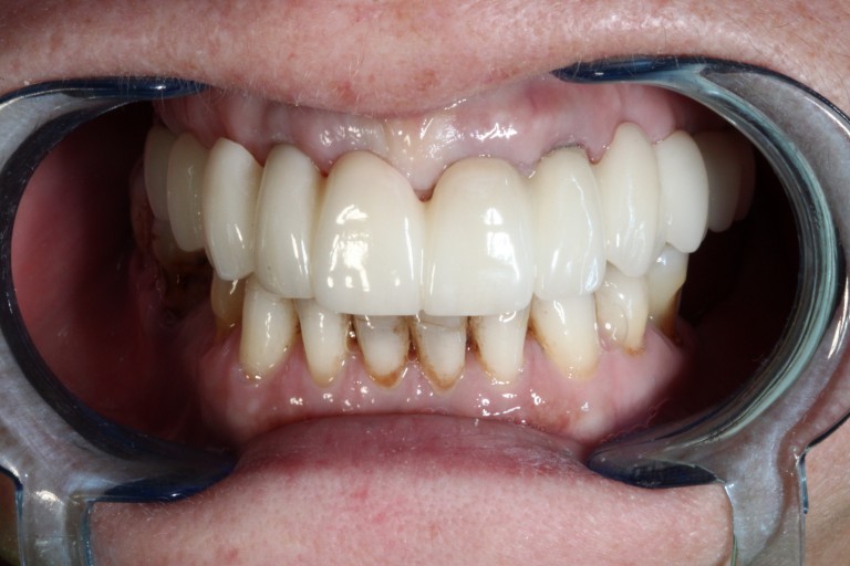 dentysta iława